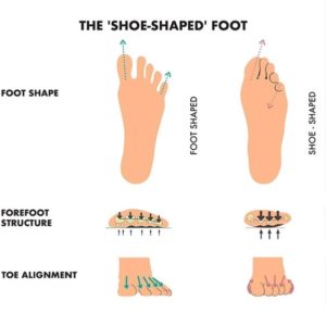 Toe In Toe Out - Getting Your Correct Shoe Alignment 